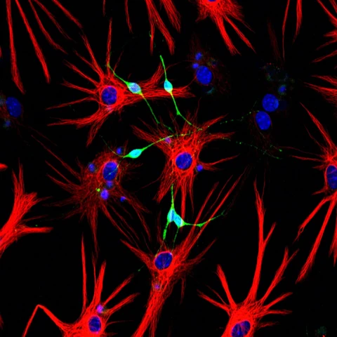 Sternförmige Stammzellen in Rot bilden neue Nervenzellen in Grün.