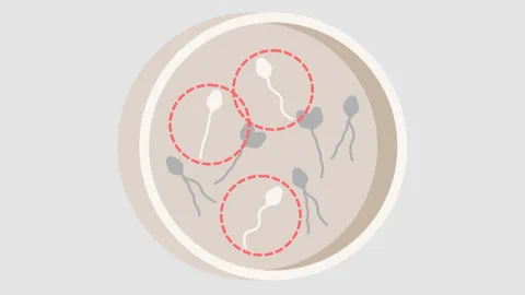 Illustration von Spermien unter einem Mikroskop.