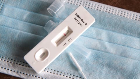 Wer verreist, muss den Corona-Test selber berappen Wer verreist, muss den Corona-Test selber berappen