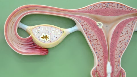 Nachteile gebärmutter entfernen Endometriumablation: Definition,