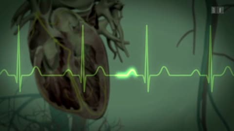 Warum Das Herz Stolpert Und Rast Wissen Srf