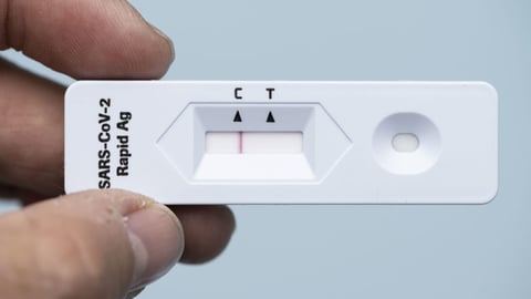 Nicht alle Kantone wollen kostenpflichtige Schnelltests