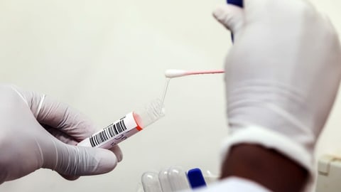 BAG empfiehlt viel mehr Corona-Tests BAG empfiehlt viel mehr Corona-Tests