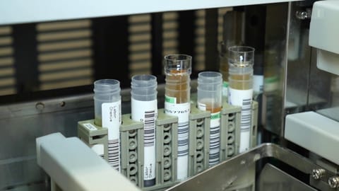 Herzinfarkt schneller ausschliessen