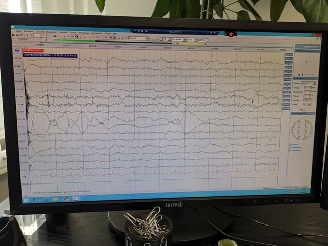 Monitor mit Kurzen darauf. Monitor mit Kurzen darauf.