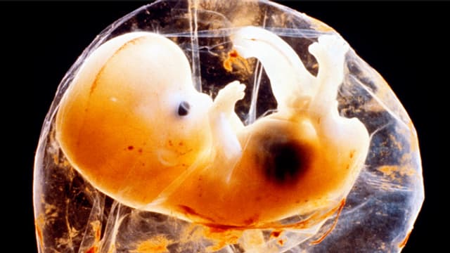 Ein menschliches Embryo. Ein menschliches Embryo.