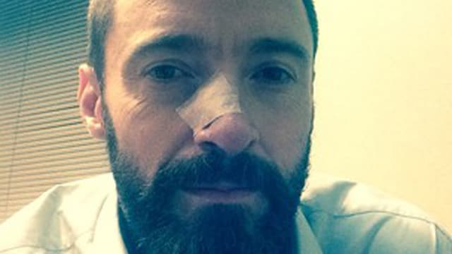 Eine nahe Aufnahme von Hugh Jackman mit Pflaster. Eine nahe Aufnahme von Hugh Jackman mit Pflaster.