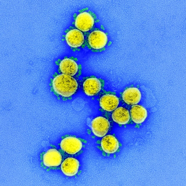 Aufnahme des neuen Coronavirus, gelb eingefärbt. Aufnahme des neuen Coronavirus, gelb eingefärbt.