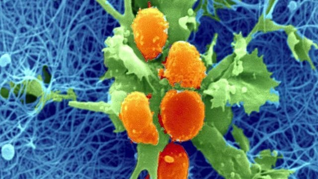 Zelle aus einem Lymphknoten. Zelle aus einem Lymphknoten.