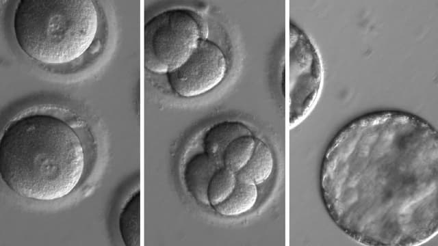 Embryo nach der Co-Injektion eines gen-korrigierenden Enzyms mit Sperma eines herzkranken Spenders. Embryo nach der Co-Injektion eines gen-korrigierenden Enzyms mit Sperma eines herzkranken Spenders.