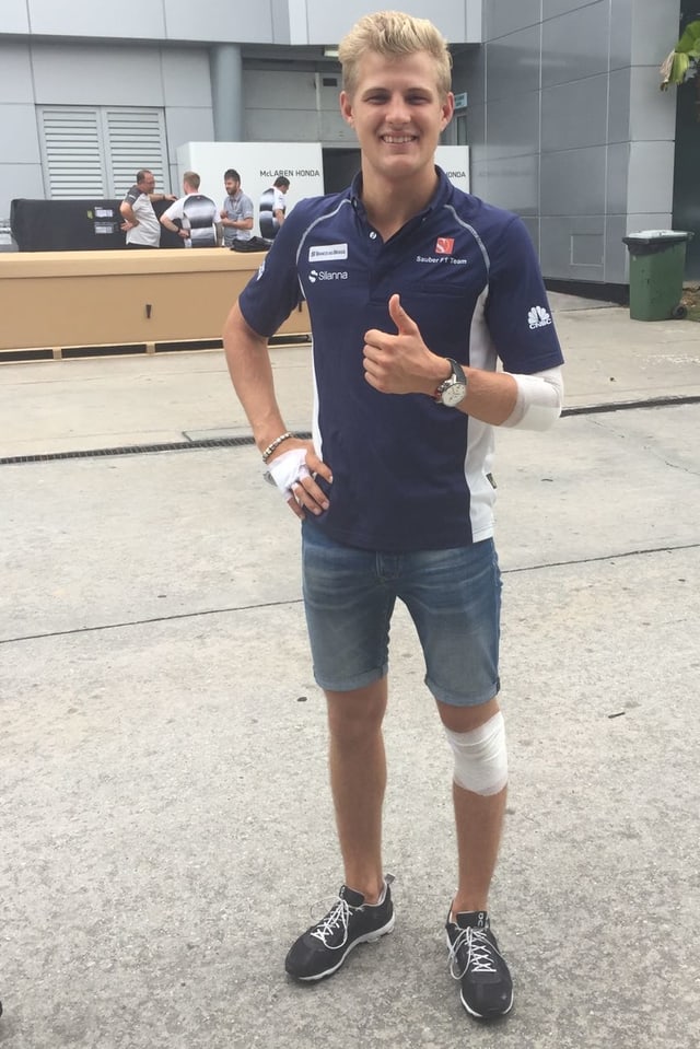 Marcus Ericsson zeigt seine Verletzungen Marcus Ericsson zeigt seine Verletzungen