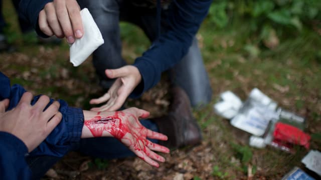 Arm mit Blut, jemand tupft ihn ab. Arm mit Blut, jemand tupft ihn ab.
