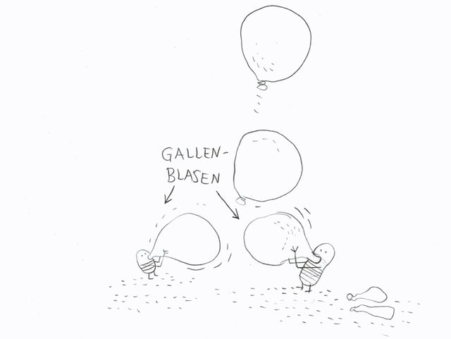Illustration von Gallenblasen. Illustration von Gallenblasen.