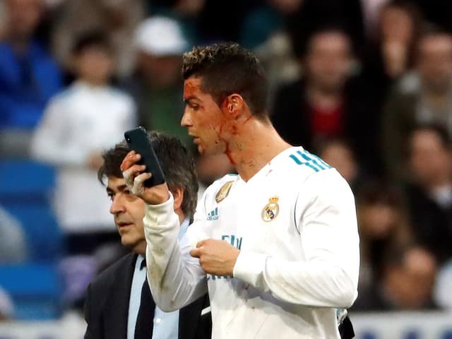 Der blutüberströmte Ronaldo benutzt ein Smartphone, um das Ausmass seiner Verletzung zu überprüfen. Der blutüberströmte Ronaldo benutzt ein Smartphone, um das Ausmass seiner Verletzung zu überprüfen.
