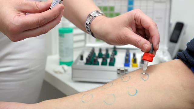 Auf einen Arm mit grünen Kreisen wird mit einer Pipette Flüssigkeit getropft. Auf einen Arm mit grünen Kreisen wird mit einer Pipette Flüssigkeit getropft.