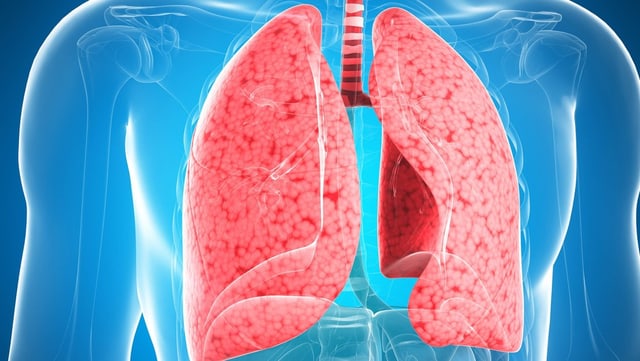 Pneumonie mit Kortison besser behandeln