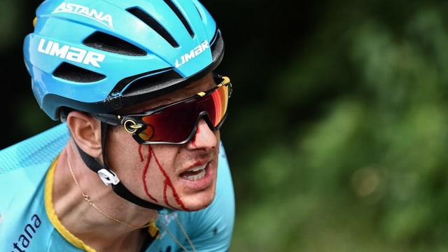 Jakob Fuglsang blutet nach dem Sturz im Gesicht. Jakob Fuglsang blutet nach dem Sturz im Gesicht.