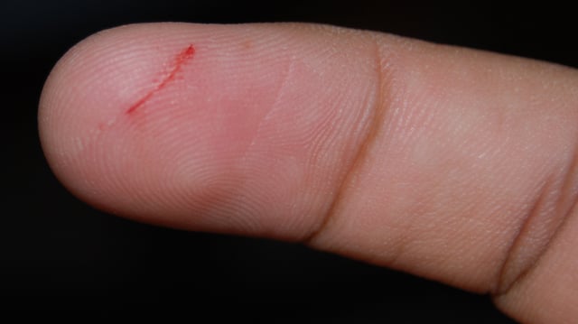Eine Fingerkuppe mit einer blutenden Papierschnittwunde Eine Fingerkuppe mit einer blutenden Papierschnittwunde