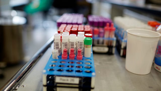 HIV-Infektionen. HIV-Infektionen.