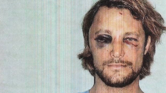 Ein Mann mit blaubem Auge und Kratzer im Gesicht. Ein Mann mit blaubem Auge und Kratzer im Gesicht.