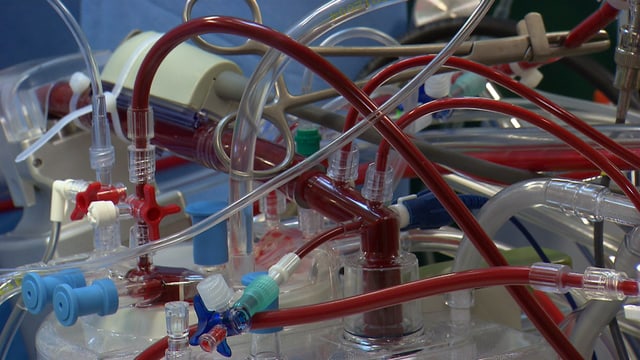 Diverse Schläuche, durch die das Blut der Patientin fliesst. Diverse Schläuche, durch die das Blut der Patientin fliesst.