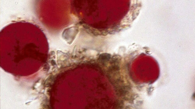 Blutschnee unter dem Mikroskop