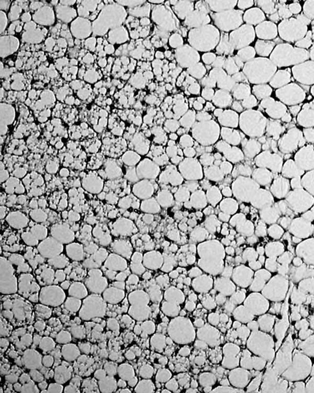 In weissem Fettgewebe entstehen so genannte «brite» Fettzellen mit vielen kleinen Lipid-Tröpfchen. Zu sehen sind sie vor allem auf der linken Seite dieser Mikroskop-Aufnahme. In weissem Fettgewebe entstehen so genannte «brite» Fettzellen mit vielen kleinen Lipid-Tröpfchen. Zu sehen sind sie vor allem auf der linken Seite dieser Mikroskop-Aufnahme.