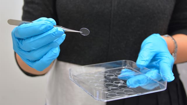 Zwei Hände in blauen Handschuhen halten eine Pinzette und Glasschale, darin kleine, runde, durchsichtige Silikonplättchen. Zwei Hände in blauen Handschuhen halten eine Pinzette und Glasschale, darin kleine, runde, durchsichtige Silikonplättchen.