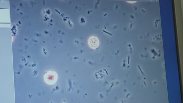 Mikroskopbild Mikroskopbild