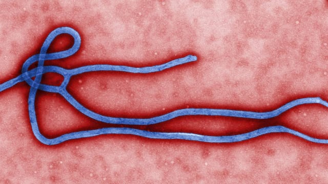 Das Ebola-Virus unter dem Mikroskop. Das Ebola-Virus unter dem Mikroskop.