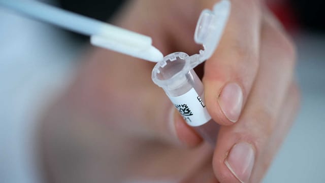 DNA-Probe. DNA-Probe.