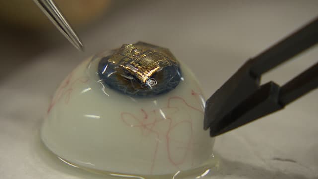 Ein Chip auf einem künstlichen Auge. Ein Chip auf einem künstlichen Auge.