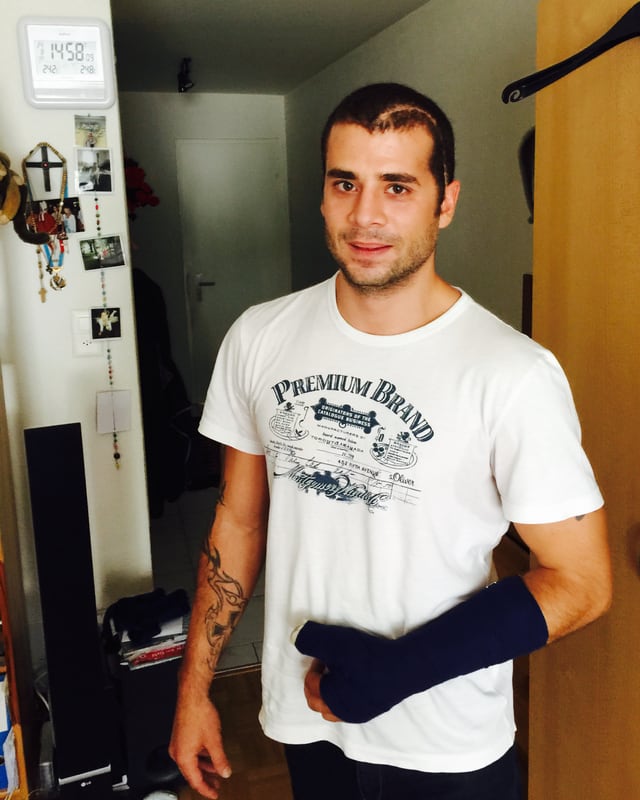 Flavio Papaleo, mit Gips und Narbe am Kopf. Flavio Papaleo, mit Gips und Narbe am Kopf.