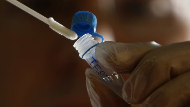 DNA-Test DNA-Test