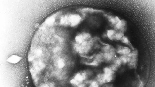 Urbakterium unter dem Mikroskop