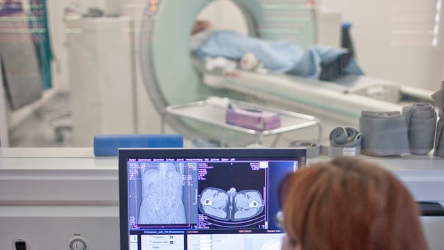 Computertomografie. Computertomografie.