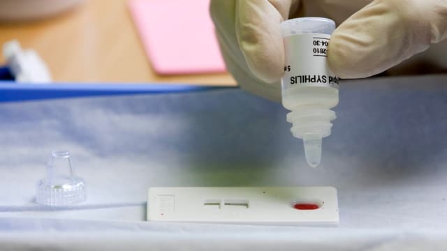 Ein Schnelltest auf Syphilis. Ein Schnelltest auf Syphilis.