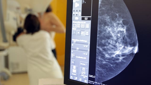 Eine Mammographieaufnahme, im Hintergrund eine Ärztin und Patientin bei der Mammographie. Eine Mammographieaufnahme, im Hintergrund eine Ärztin und Patientin bei der Mammographie.