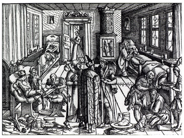 Holzschnitt einer Amputation im 16. Jahrhundert