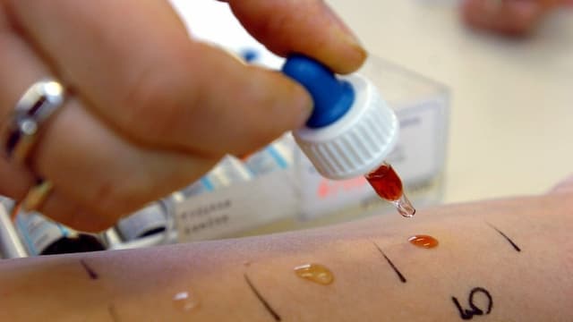 Sollen sich Allergiker gegen Covid-19 impfen lassen?