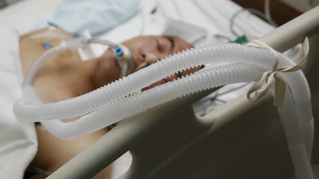 Ein Mann mit Beatmungsschlauch im Mund liegt im Spitalbett. Ein Mann mit Beatmungsschlauch im Mund liegt im Spitalbett.