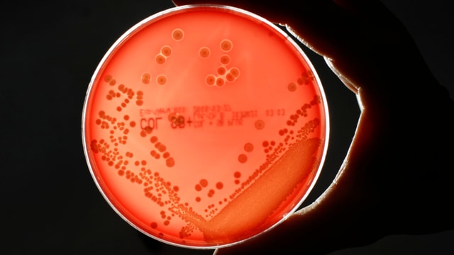 Bakterienkulturen in einer Schale