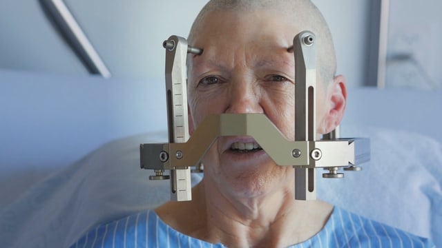 Frau mit kahlem Schädel und daran festgemachtem Metallgestell. Frau mit kahlem Schädel und daran festgemachtem Metallgestell.