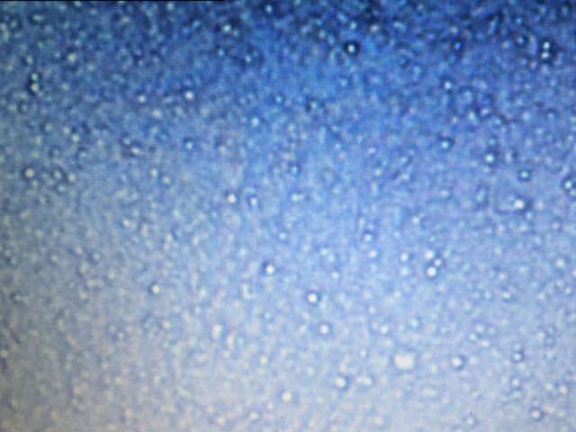 Milch unter dem Mikroskop: kleine weisse Kügelchen auf blauem Hintergrund Milch unter dem Mikroskop: kleine weisse Kügelchen auf blauem Hintergrund