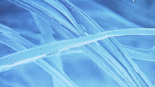 Microfasern unter dem Elektronenmikroskop. Microfasern unter dem Elektronenmikroskop.