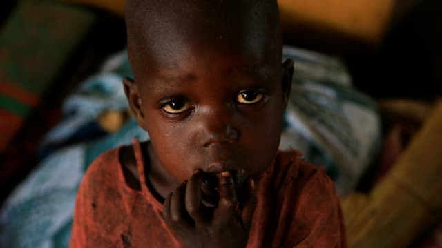 Hungerndes Kind im Südsudan. Hungerndes Kind im Südsudan.