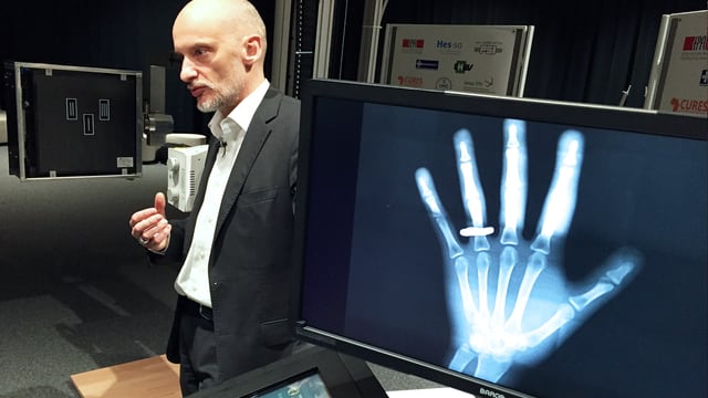 Bärtiger Mann neben einem Bildschirm mit der Röntgenaufnahme einer Hand. Bärtiger Mann neben einem Bildschirm mit der Röntgenaufnahme einer Hand.