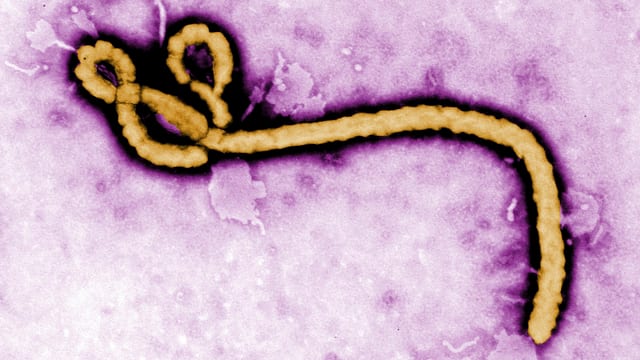 Das Ebola-Virus. Das Ebola-Virus.