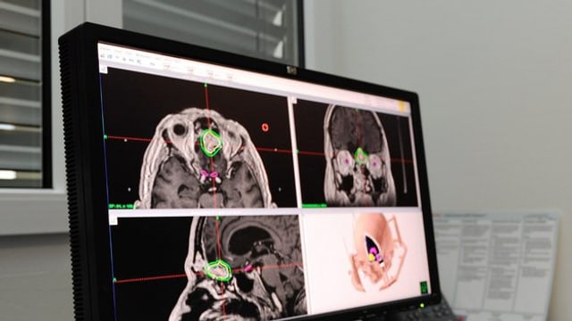 Monitor, welcher verschiedene Hirnscanns zeigt Monitor, welcher verschiedene Hirnscanns zeigt