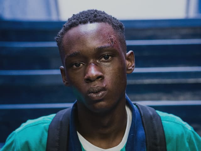 Ein afroamerikanischer Junge mit verbeultem Gesicht blickt direkt in die Kamera. Ein afroamerikanischer Junge mit verbeultem Gesicht blickt direkt in die Kamera.